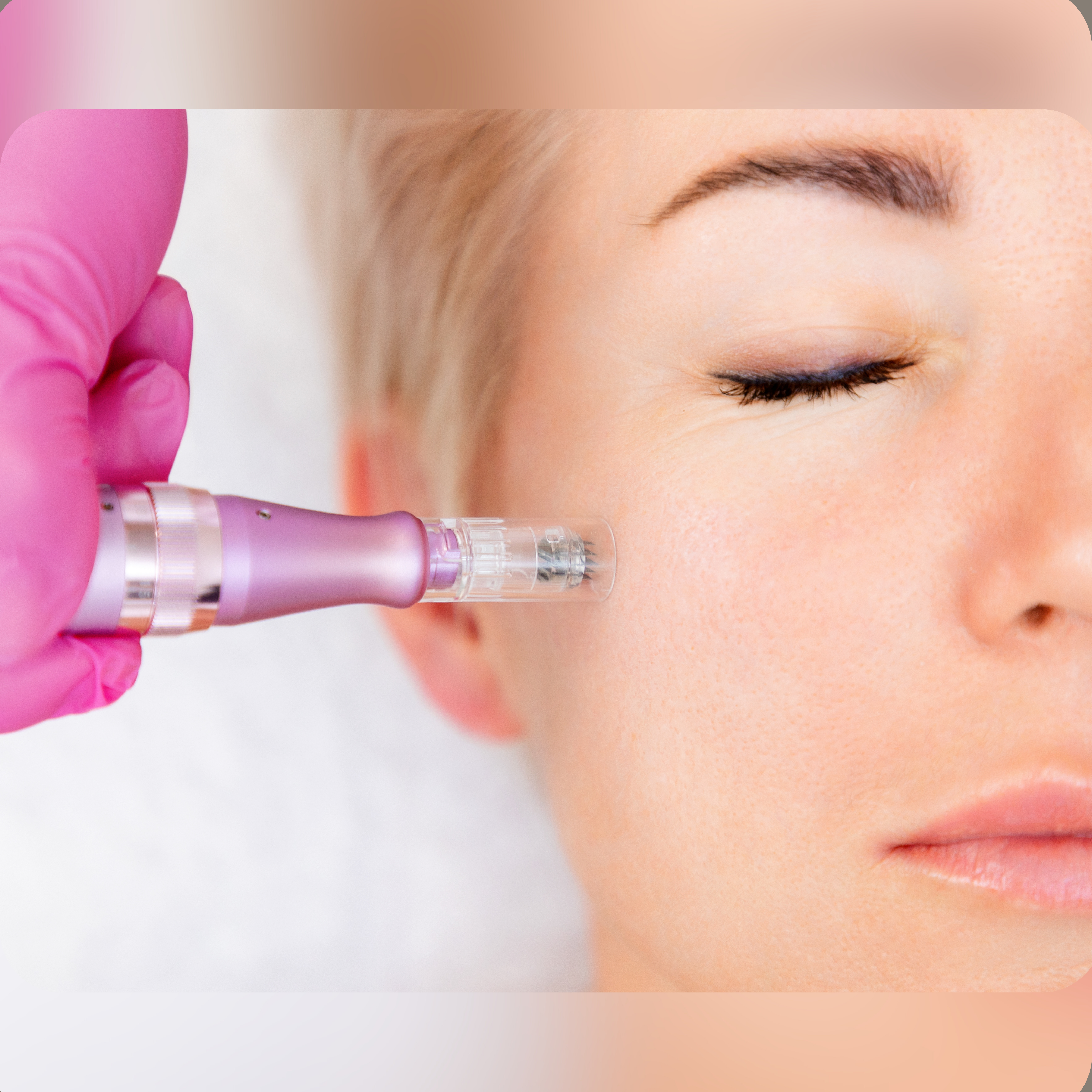 Estética